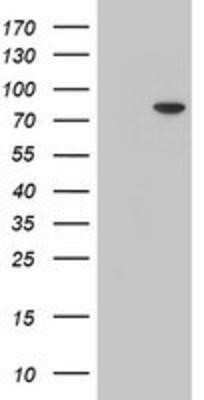 Western Blot: PALS1/MPP5 Antibody (OTI2D3)Azide and BSA Free [NBP2-73234]