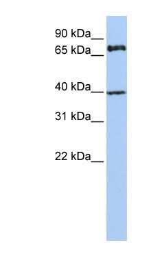 Western Blot: PALS1/MPP5 Antibody [NBP1-54724]
