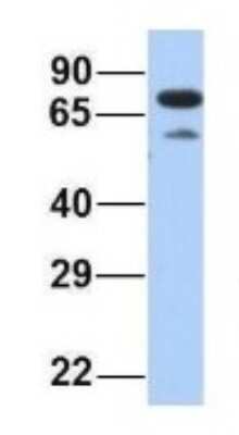 Western Blot: PALS1/MPP5 Antibody [NBP1-54724]