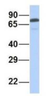 Western Blot: PALS1/MPP5 Antibody [NBP1-54724]