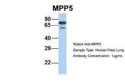 Western Blot: PALS1/MPP5 Antibody [NBP1-54724]