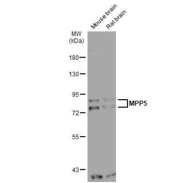 Western Blot: PALS1/MPP5 Antibody [NBP2-19389]