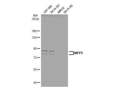 Western Blot: PALS1/MPP5 Antibody [NBP2-19389]