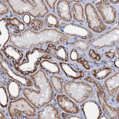 Immunohistochemistry-Paraffin: PAMCI Antibody [NBP1-80937]
