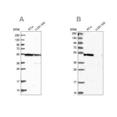 Western Blot: PAMCI Antibody [NBP1-80937]