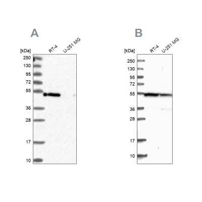 Western Blot: PAMCI Antibody [NBP1-80938]