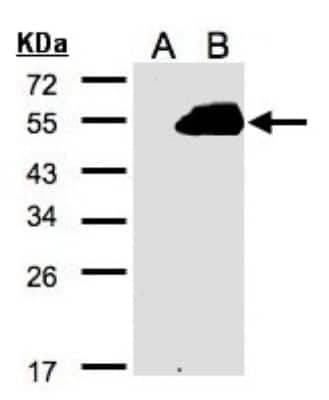 Western Blot: PAMCI Antibody [NBP2-19686]