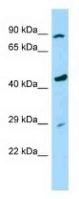 Western Blot: PAMCI Antibody [NBP3-09529]