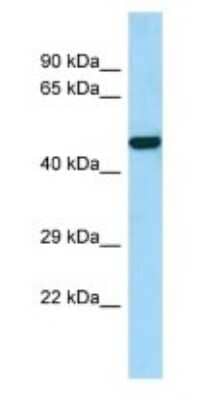 Western Blot: PAMCI Antibody [NBP3-09530]