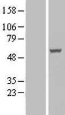 Western Blot: PAMCI Overexpression Lysate [NBL1-15181]