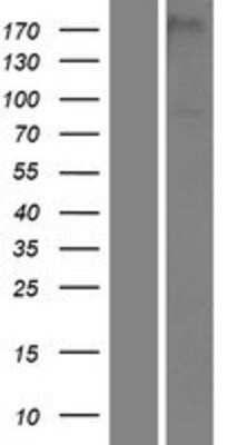 Western Blot: PAMR1 Overexpression Lysate [NBP2-08969]