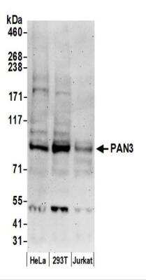Western Blot: PAN3 Antibody [NBP2-44286]