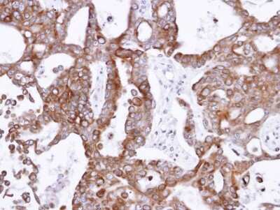 Immunohistochemistry-Paraffin: PANK1 Antibody [NBP1-32509]