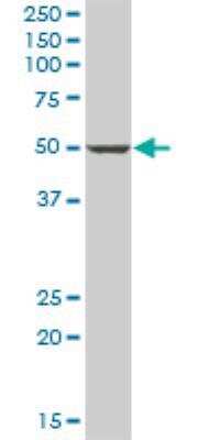 Western Blot: PANK1 Antibody [H00053354-B01P]