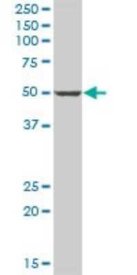 Western Blot: PANK1 Antibody [H00053354-B01P]