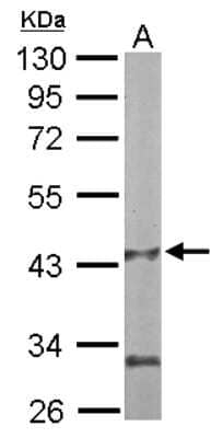 Western Blot: PANK1 Antibody [NBP1-32509]
