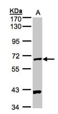 Western Blot: PANK1 Antibody [NBP1-32509]