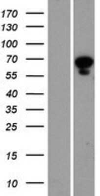 Western Blot: PANK1 Overexpression Lysate [NBP2-05420]