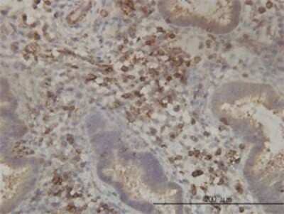 Immunohistochemistry-Paraffin: PANK2 Antibody (2B12) [H00080025-M01]