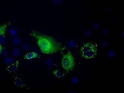 Immunocytochemistry/ Immunofluorescence: PANK2 Antibody (OTI3H9) [NBP2-02677]