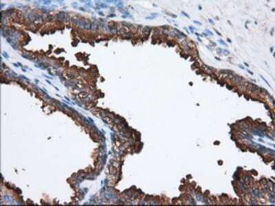 Immunohistochemistry-Paraffin: PANK2 Antibody (OTI3H9) [NBP2-02677]