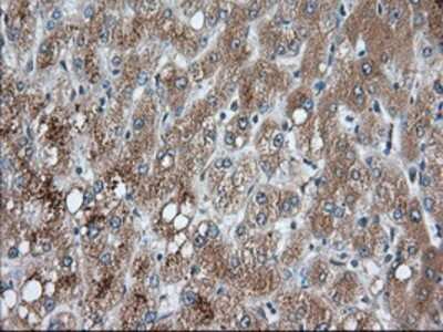 Immunohistochemistry-Paraffin: PANK2 Antibody (OTI3H9) [NBP2-02677]