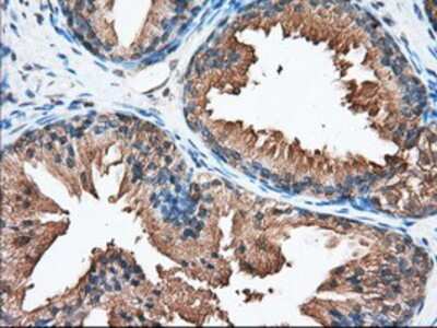 Immunohistochemistry-Paraffin: PANK2 Antibody (OTI3H9) [NBP2-02677]