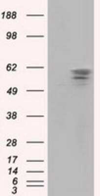 Western Blot: PANK2 Antibody (OTI3H9) [NBP2-02677]