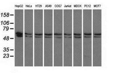Western Blot: PANK2 Antibody (OTI3H9)Azide and BSA Free [NBP2-73241]