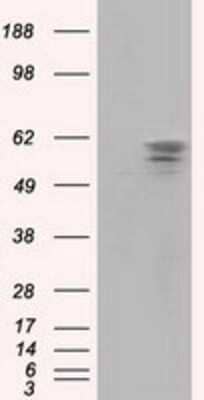 Western Blot: PANK2 Antibody (OTI3H9)Azide and BSA Free [NBP2-73241]