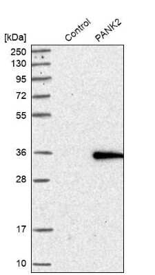 Western Blot: PANK2 Antibody [NBP1-88295]