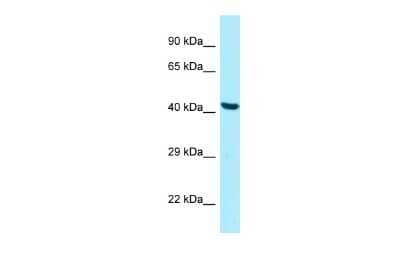 Western Blot: PANK2 Antibody [NBP2-88007]