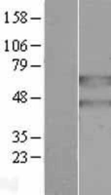 Western Blot: PANK2 Overexpression Lysate [NBL1-14091]