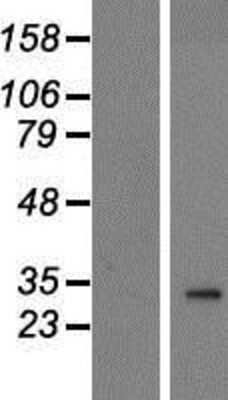 Western Blot: PANK2 Overexpression Lysate [NBP2-09917]