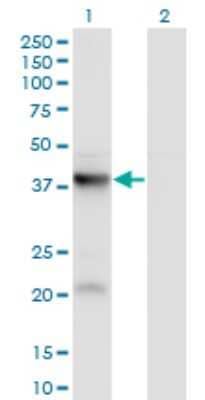 Western Blot: PANK3 Antibody (3D7) [H00079646-M01]