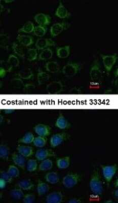 Immunocytochemistry/ Immunofluorescence: PANK3 Antibody [NBP1-32638]