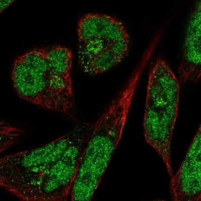 Immunocytochemistry/ Immunofluorescence: PANK3 Antibody [NBP2-56584]