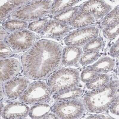 Immunohistochemistry-Paraffin: PANK3 Antibody [NBP3-17749]