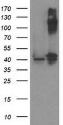 Western Blot: PANK3 Antibody (OTI3C4)Azide and BSA Free [NBP2-73244]