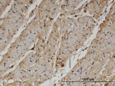 Immunohistochemistry-Paraffin: PANK4 Antibody (4F10) [H00055229-M04]