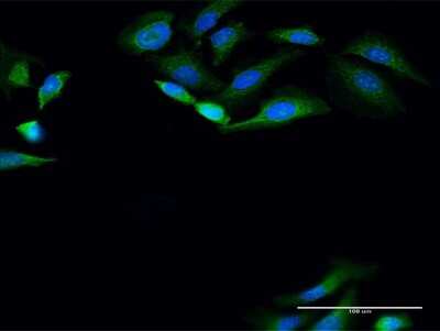 Immunocytochemistry/ Immunofluorescence: PANK4 Antibody [H00055229-D01P]
