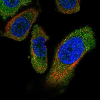 Immunocytochemistry/ Immunofluorescence: PANK4 Antibody [NBP2-55206]