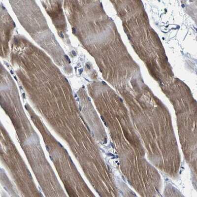 Immunohistochemistry-Paraffin: PANK4 Antibody [NBP1-83831]