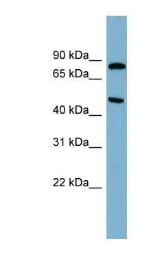 Western Blot: PANK4 Antibody [NBP1-55012]