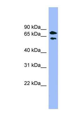 Western Blot: PANK4 Antibody [NBP1-55013]