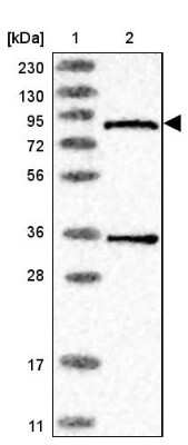 Western Blot: PANK4 Antibody [NBP1-83832]