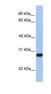 Western Blot: PAOX Antibody [NBP1-70666]