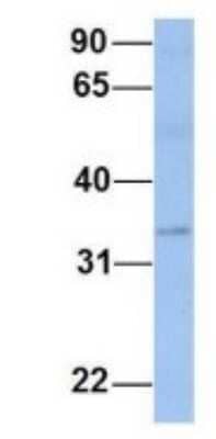 Western Blot: PAOX Antibody [NBP1-70666]