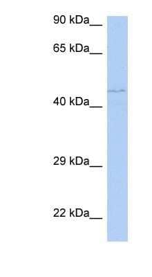 Western Blot: PAOX Antibody [NBP1-70667]