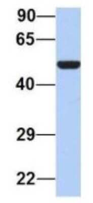 Western Blot: PAOX Antibody [NBP1-70667]